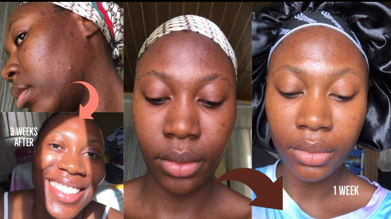 Radiance Glow Brightening Soap